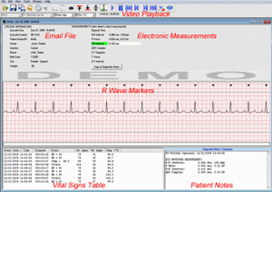 ECG File Reviewer